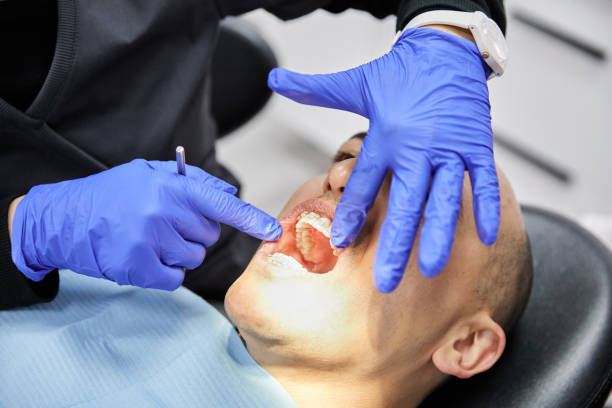 Best Emergency Dental Care for Sports Injuries in Long View, NC