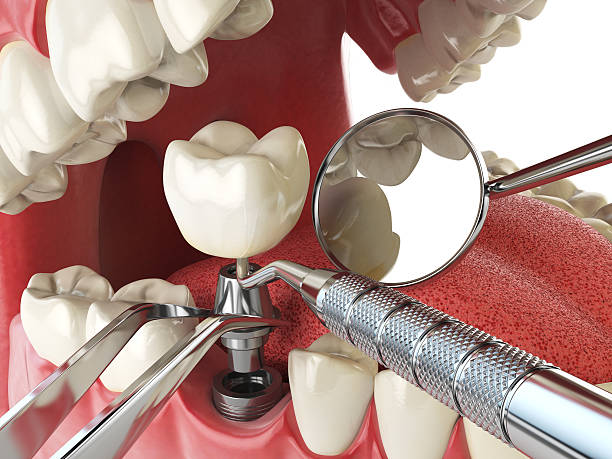 Best Emergency Treatment for Oral Infections in Long View, NC